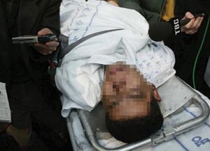 소외계층이 토해낸  ‘분노의 역류’