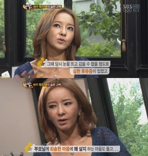 곽진영 성형 후유증 고백…"눈 뜨기도 감기도 힘들어"