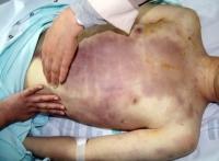 '윤일병 사망 사건' '김해여고생 살인사건' 비인간적 엽기행각에 국민들 '멘붕' 