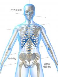 “안면비대칭, 미용뿐만 아니라 건강 해쳐”