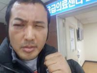 김보성, ‘로드FC 데뷔전’ 부상으로 ‘눈뼈 골절’…“수술 위기”