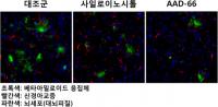 포항공대 정성기-김경태 교수팀, 약물전달체 기술 활용 알츠하이머 치료제 개발