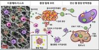 수술 후 암 재발-전이 방지기술 개발